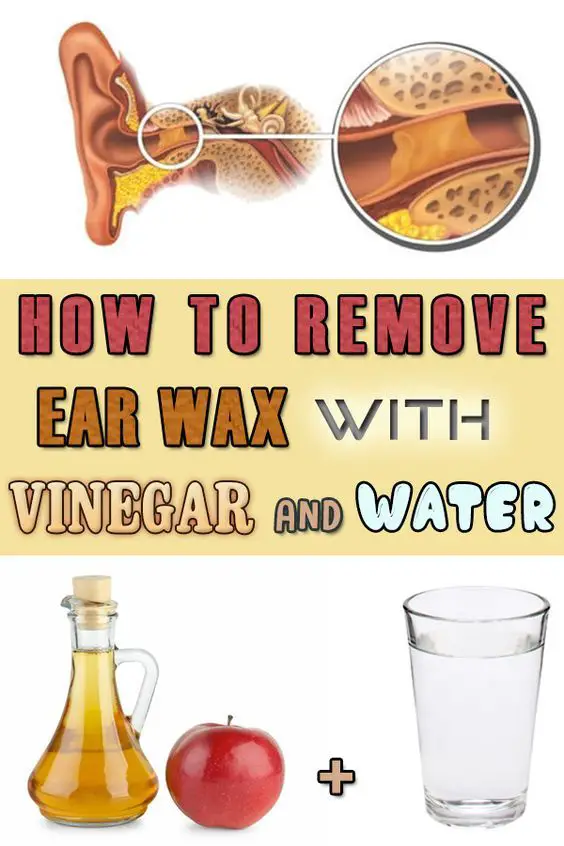 Ways On How to Unclog Ears From Congestion