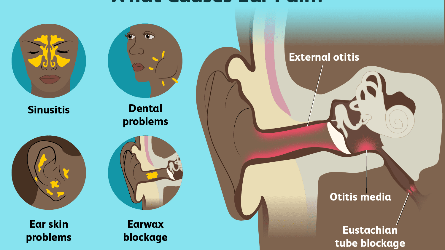 Ways on How to Pop Your Ears