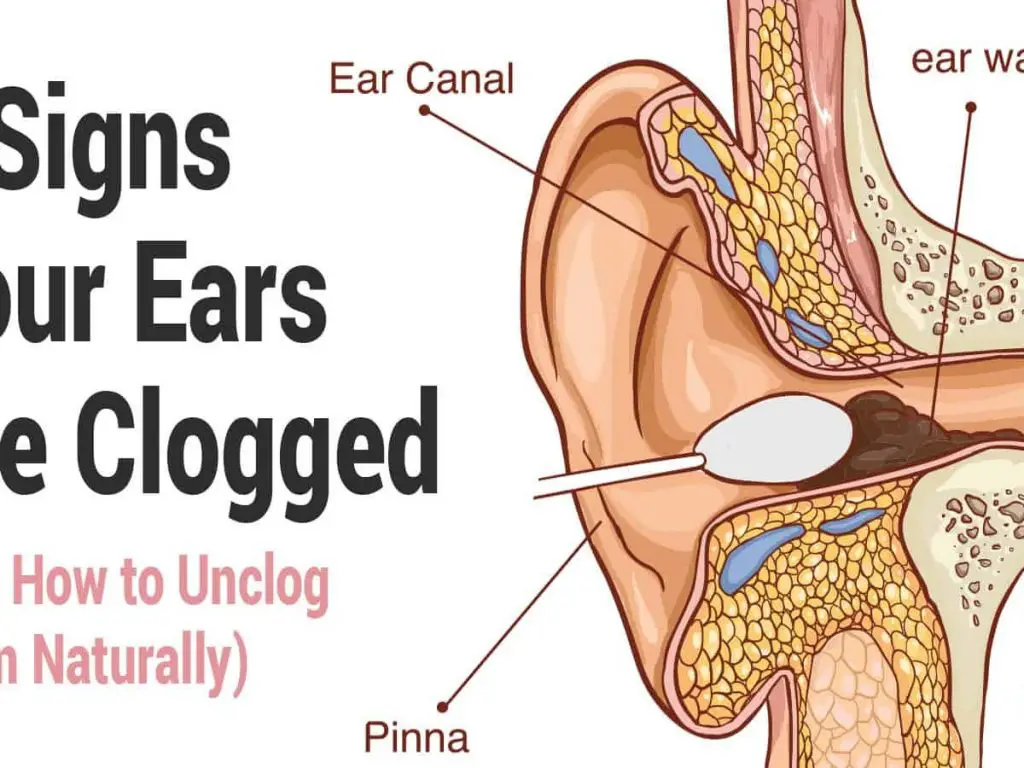 Causes of a Clogged Ear Pulsatile Tinnitus