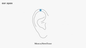 Ear Pressure After Running - Causes and Treatments
