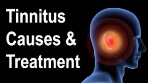 Tinnitus Causes - Could My Antidepressant Be the Cause